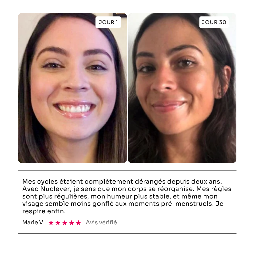 A side-by-side comparison of a woman's face, showing a before photo labeled 'Day 1' and an after photo labeled 'Day 30'.
