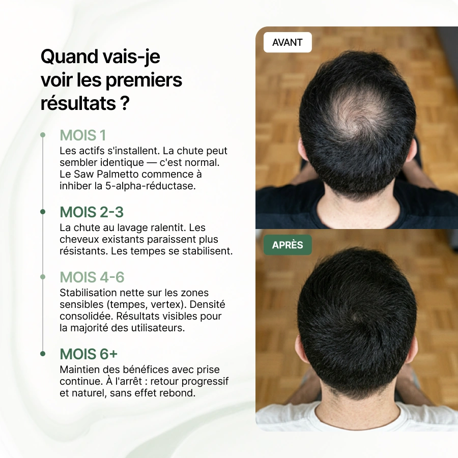 Before and after photos showing hair regrowth on the crown of a man's head.