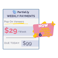 Payment Plan - Pop On Veneers