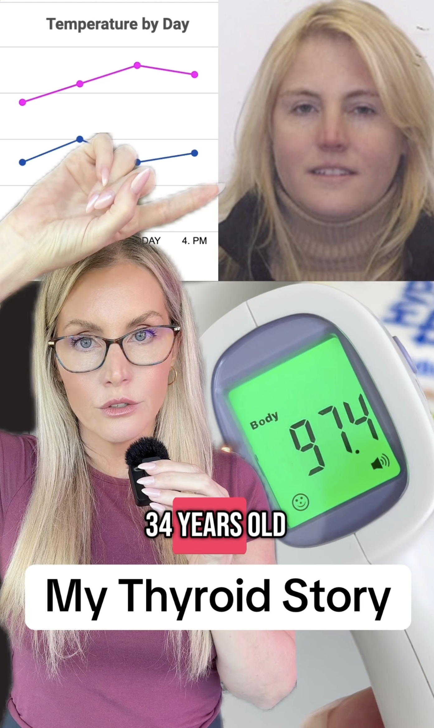 Collage of a woman, temperature graph, thermometer, and text 'My Thyroid Story'.