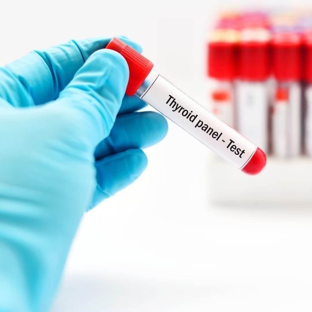 Gloved hand holding a test tube labeled 'Thyroid panel - Test'.