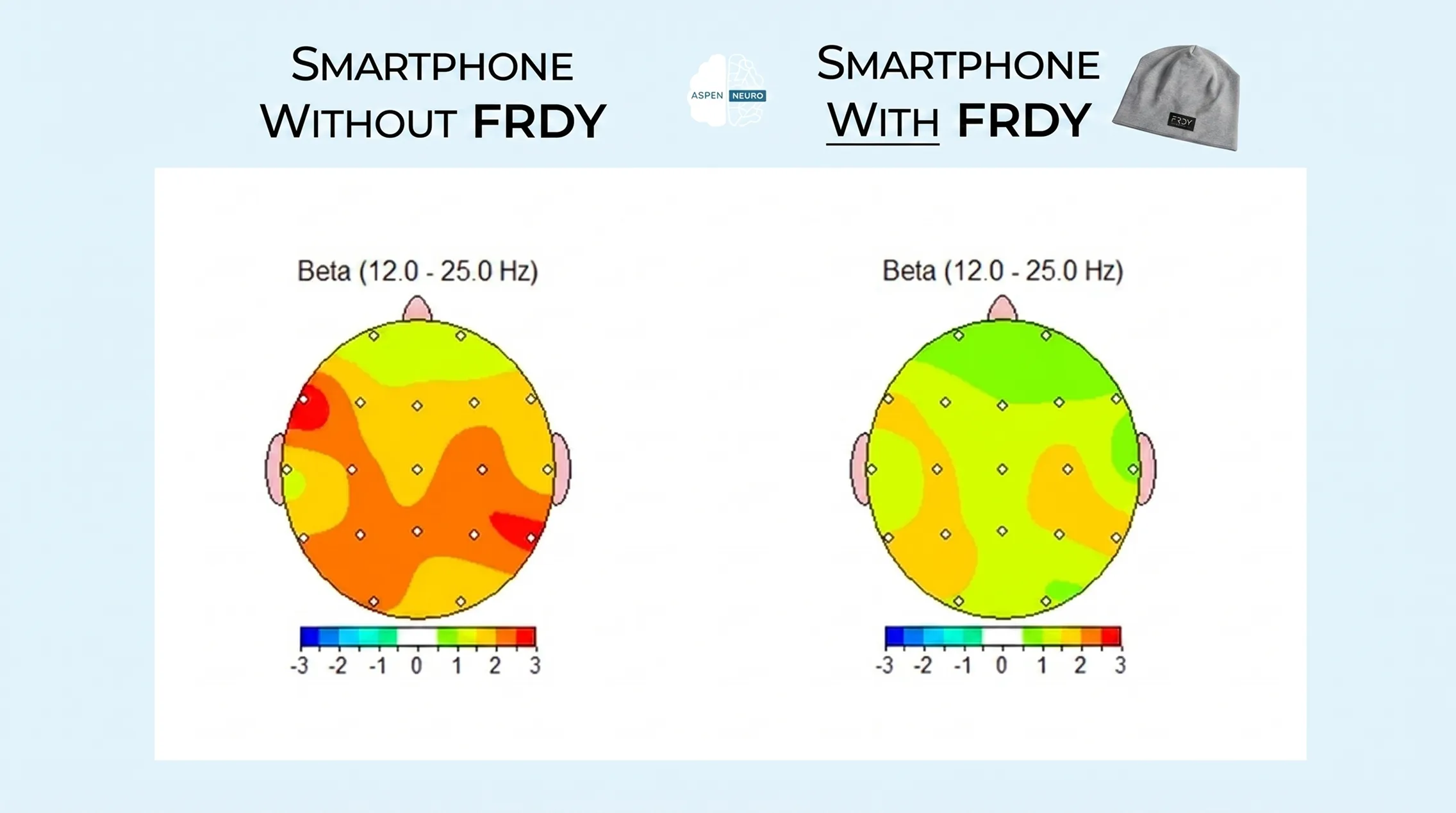 A comparison of two brain maps showing beta wave activity, one 'Without FRDY' and one 'With FRDY'.