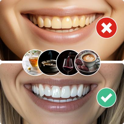 Illustration showing effects of certain foods on teeth yellowing and whitening.