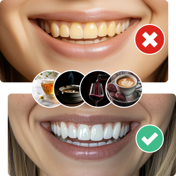 Teeth whitening comparison: stained teeth and drinks versus clean, whitened teeth.