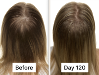 A before and after comparison of a woman's scalp, showing thicker hair and less scalp visibility after 120 days.