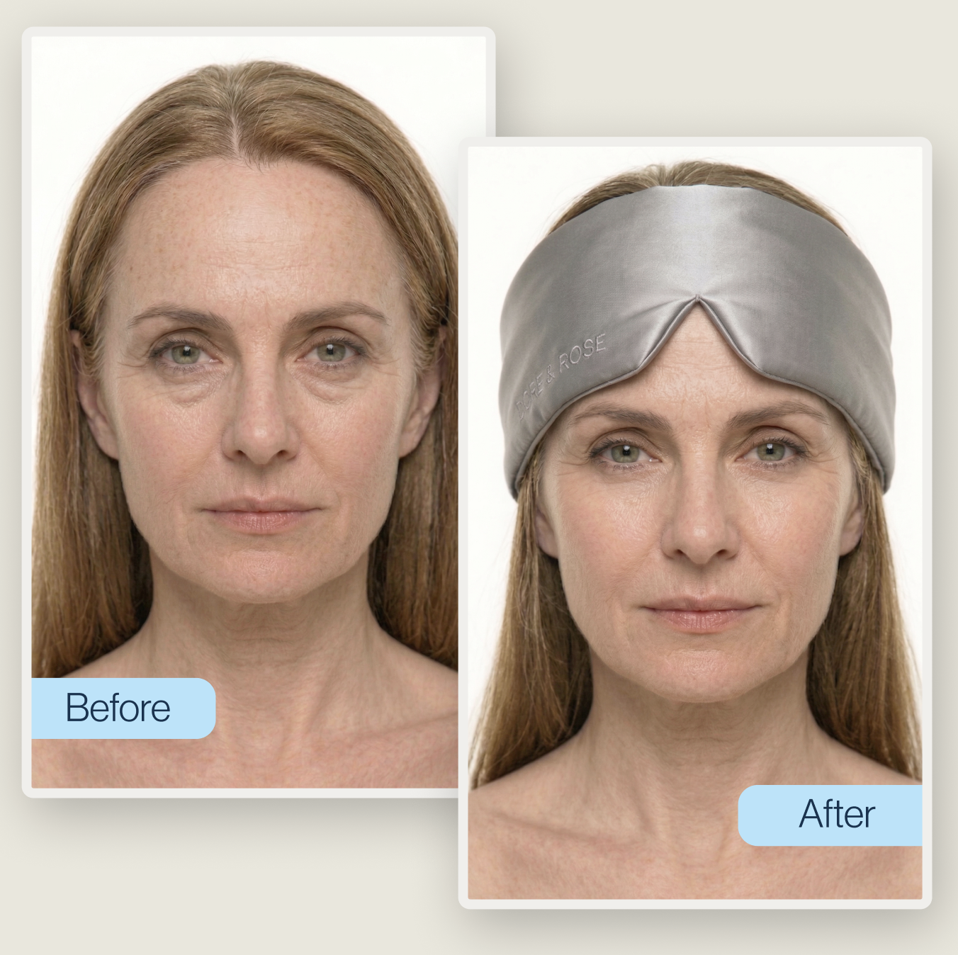 Anti-aging skin and hair benefits of silk