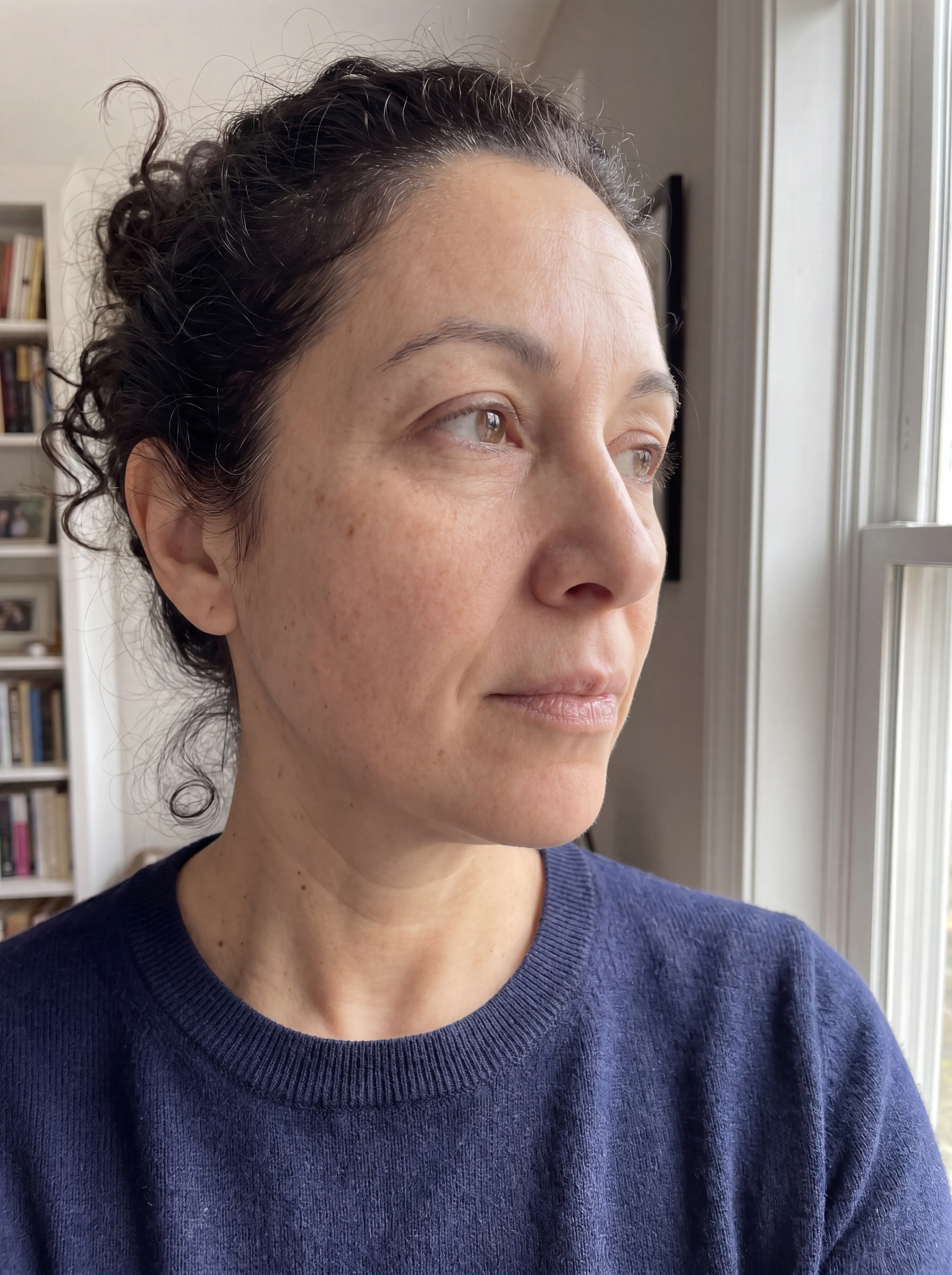 Sandra, after 10 weeks of Dark Spot Corrector Serum