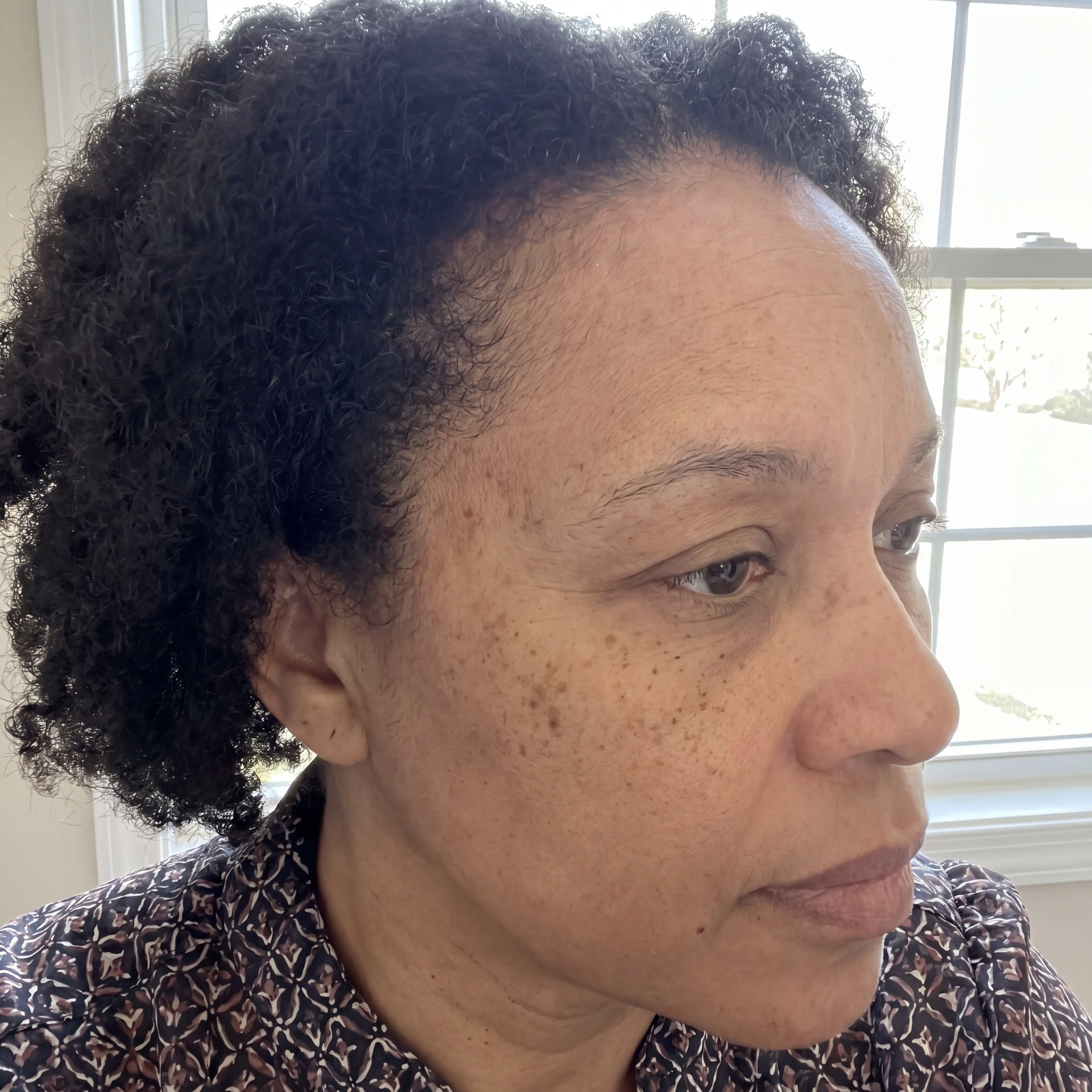 Tamara, before using Dark Spot Corrector Serum