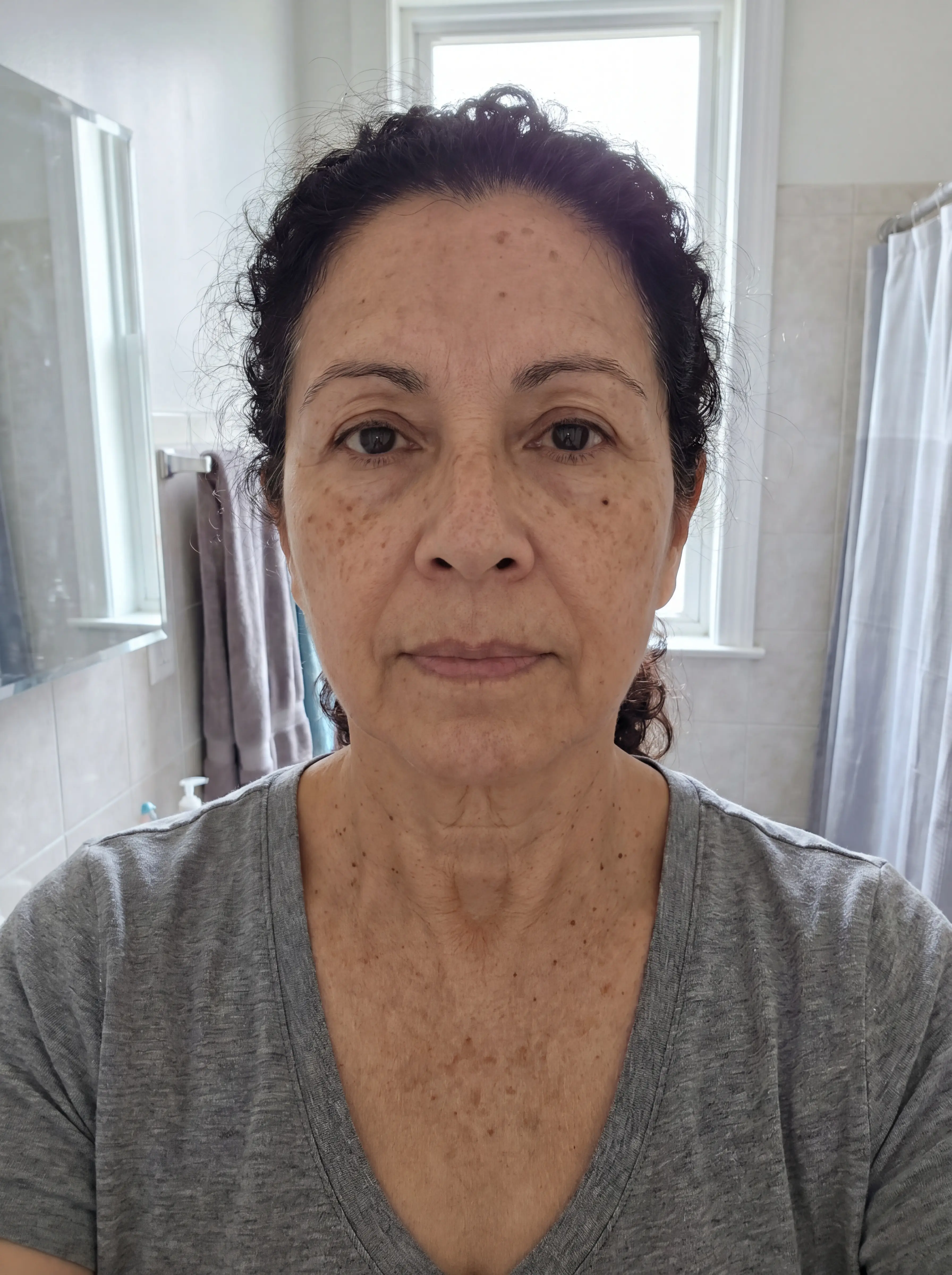 Lourdes, before using Dark Spot Corrector Serum