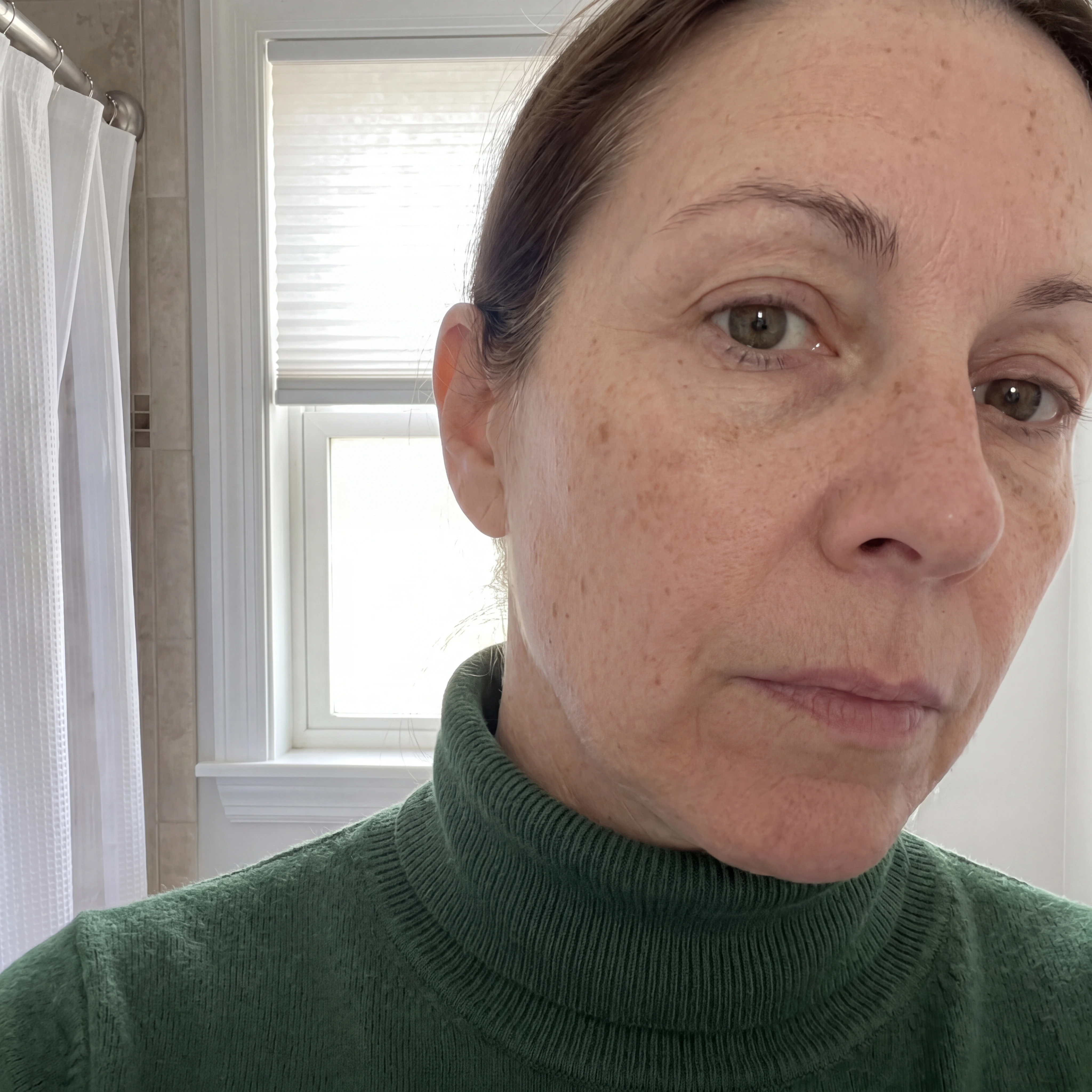 Rachel, before using Dark Spot Corrector Serum