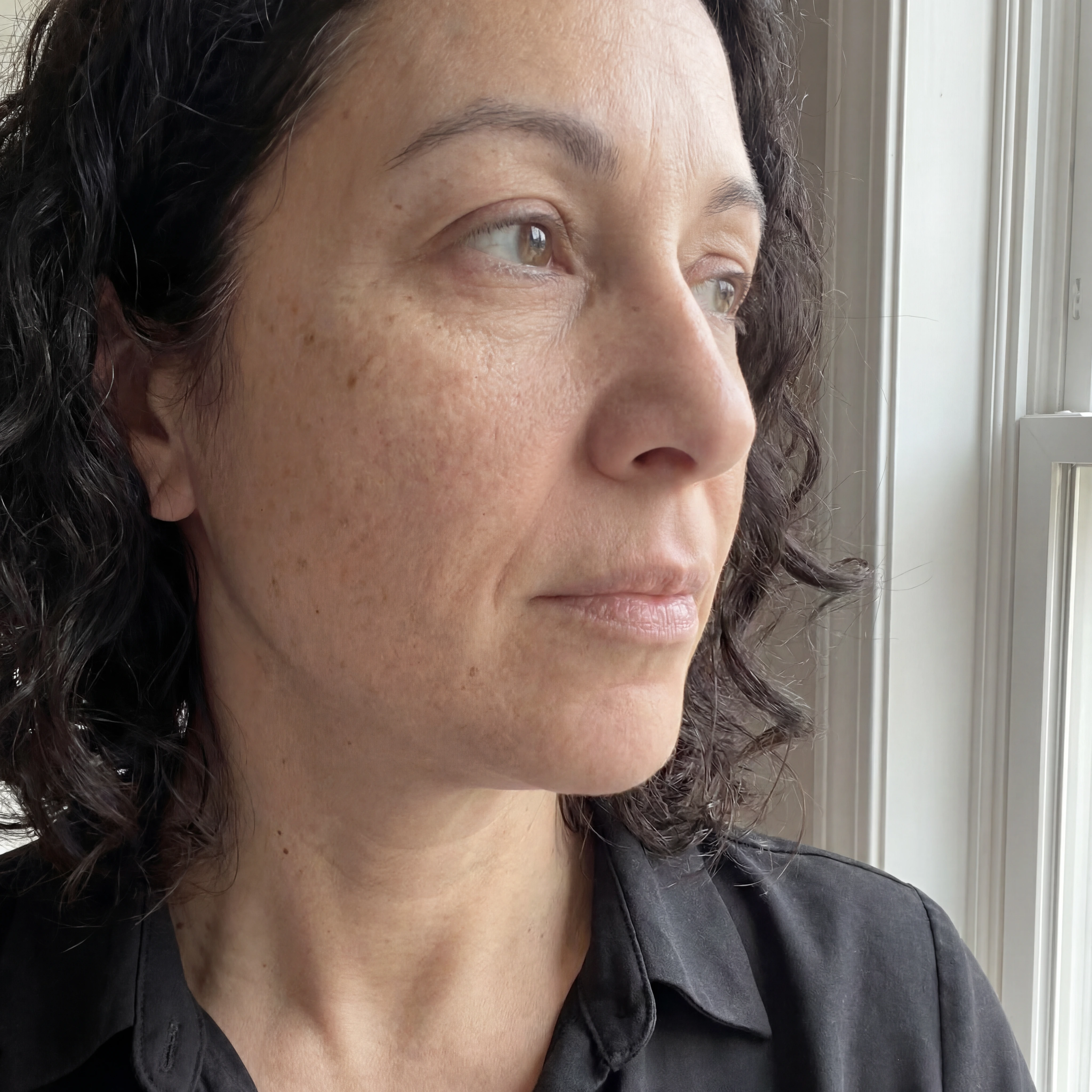 Sandra, before using Dark Spot Corrector Serum
