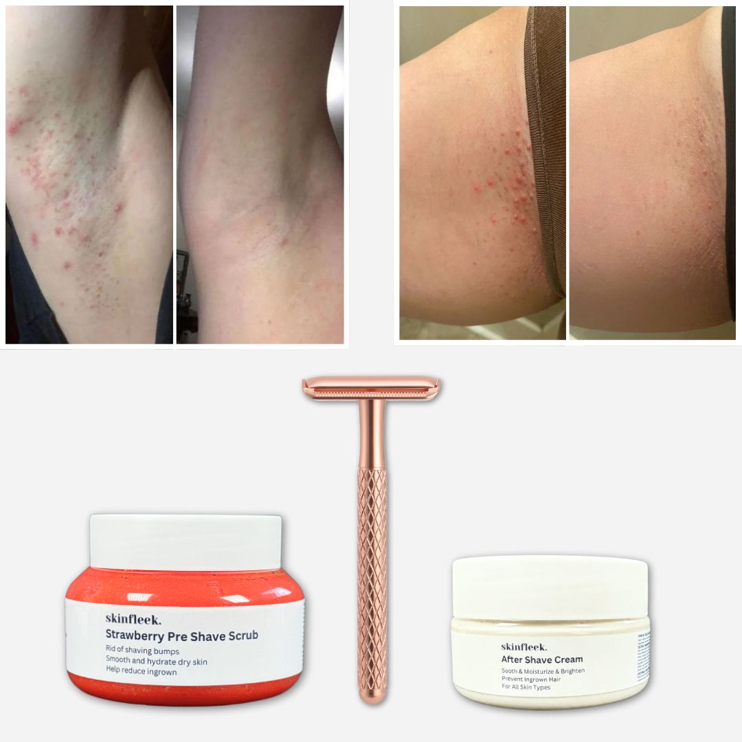 Before and after images of skin with shaving bumps, razor, and skincare products.
