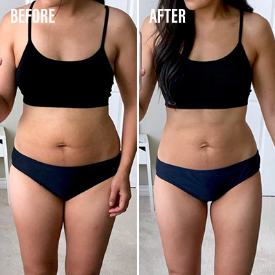 Side-by-side comparison of a woman in black underwear labeled 'Before' and 'After.'