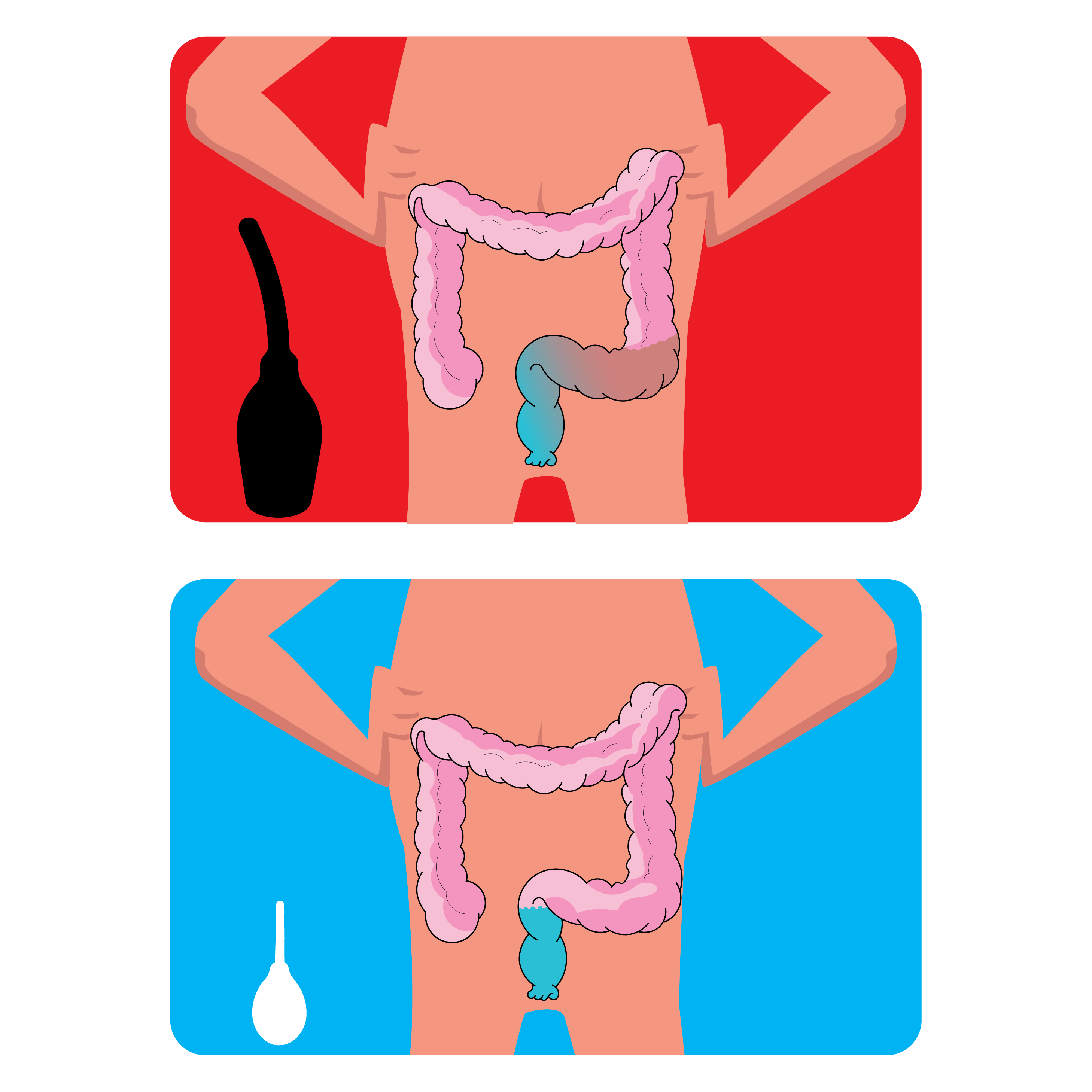 Illustration of intestines with enema tools on red and blue backgrounds.