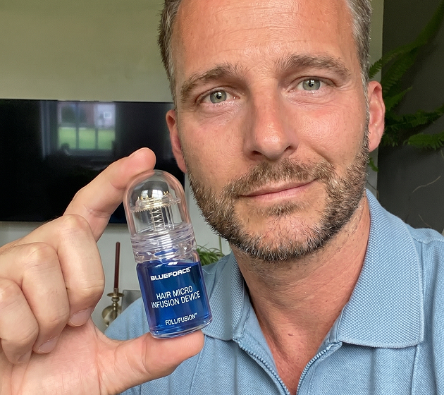 A man in a blue collared shirt holds a small Blueforce Hair Micro Infusion Device to the camera.