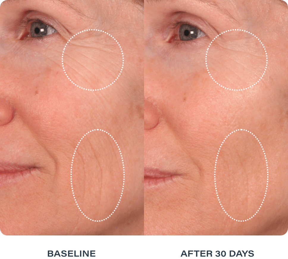 Before and after skin results