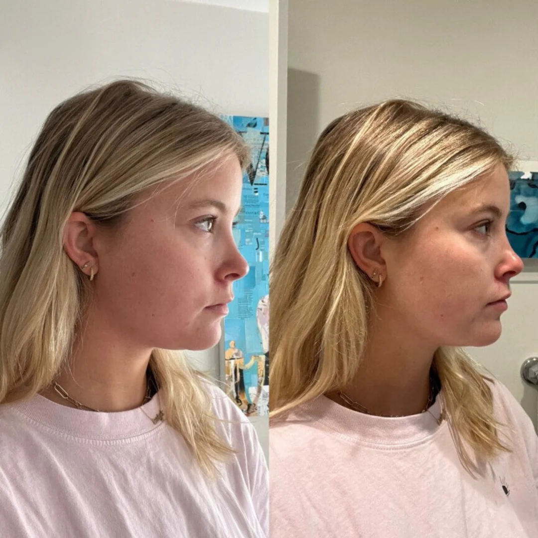 Side-by-side profile photos of a woman with blonde hair wearing a pink shirt.