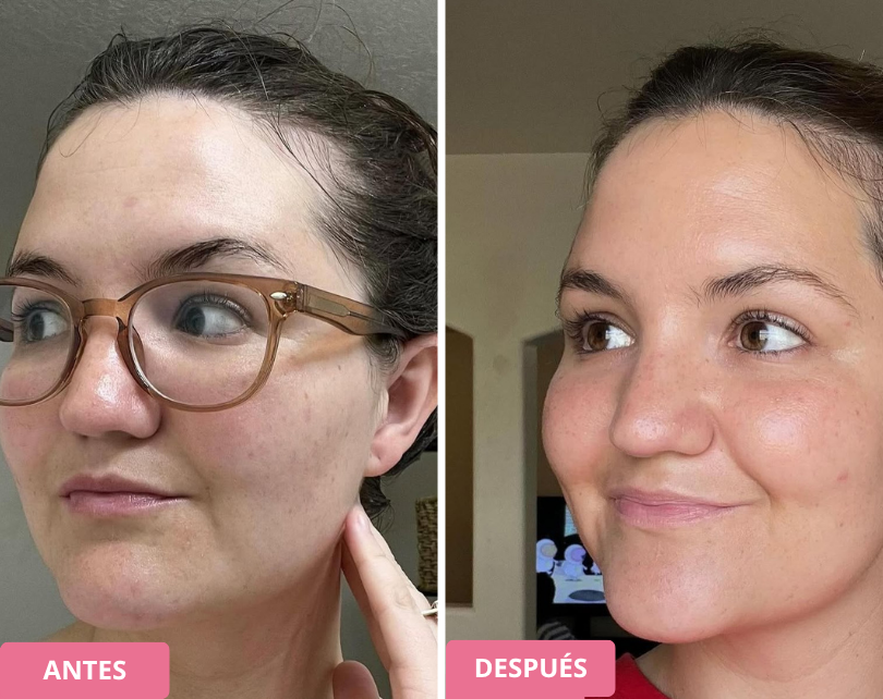 Two side-by-side headshots of a person labeled 'antes' and 'después'.