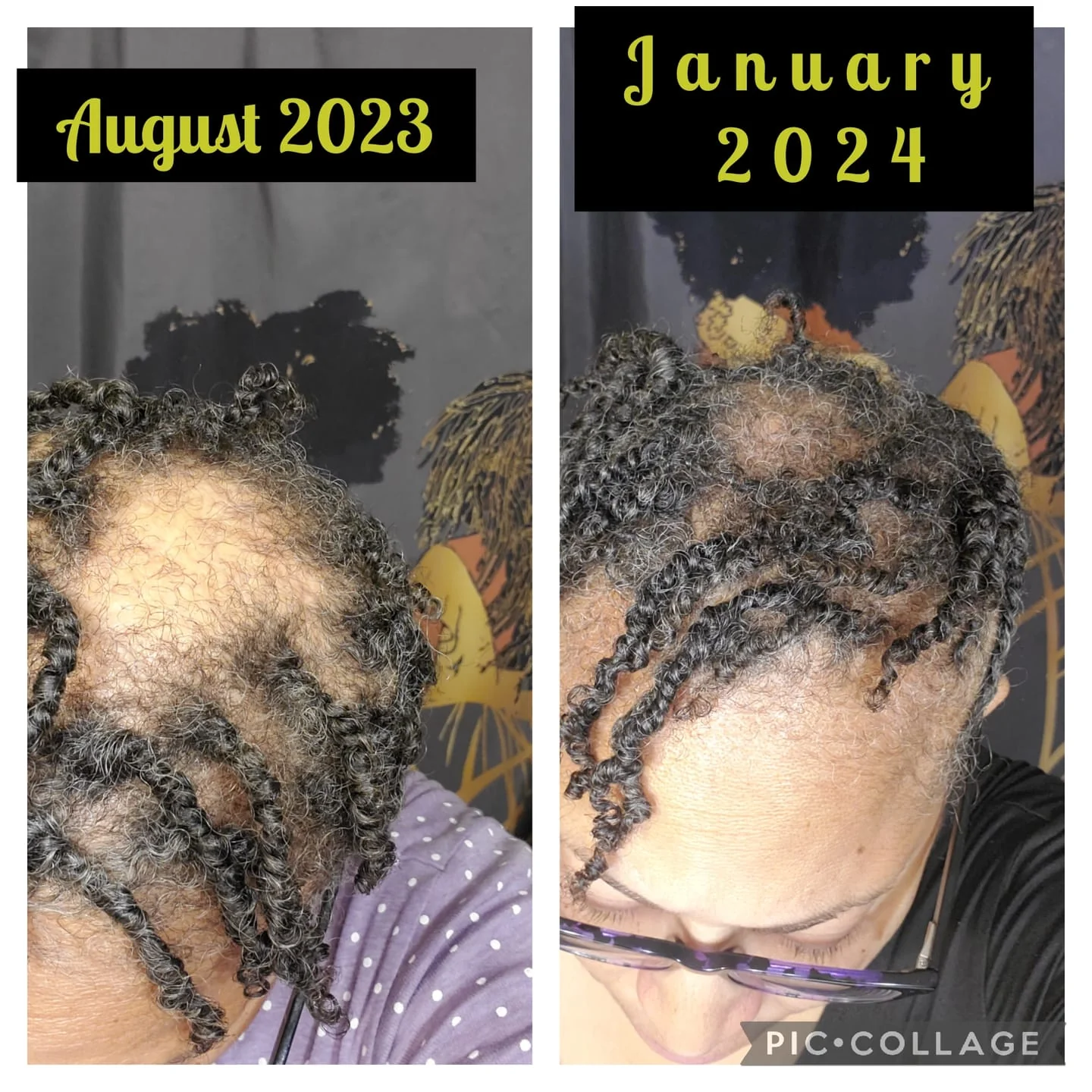 A side-by-side comparison of a person's hair in August 2023 and January 2024, showing hair growth.