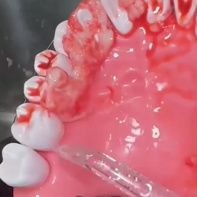 Comparison of teeth and gums before and after dental treatment.