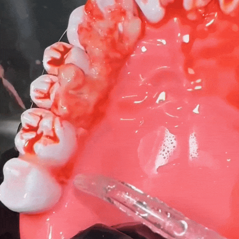 Close-up of teeth with red dental impression material.