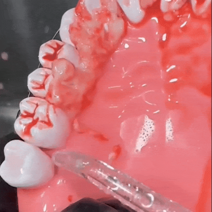 Close-up of dental model with red dye applied to teeth and gums.