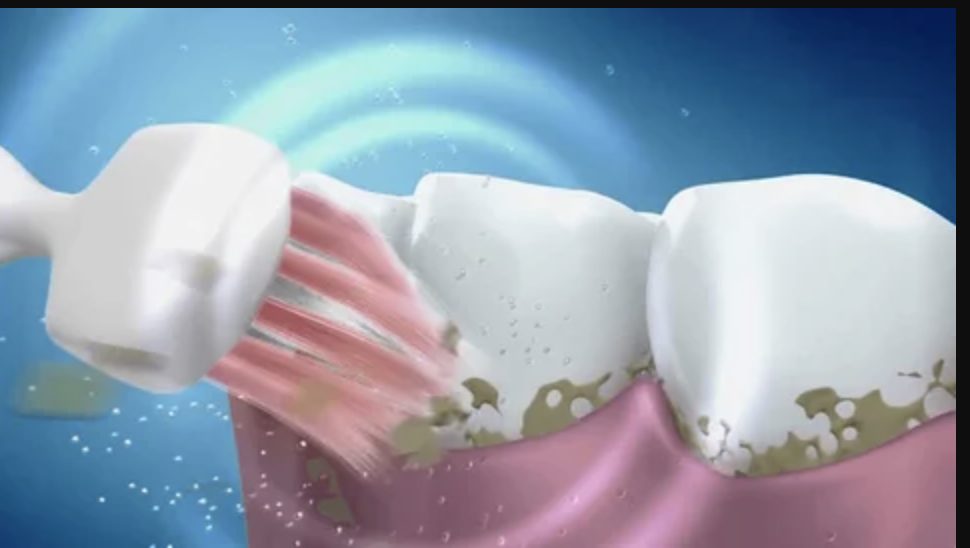 Animated toothbrush cleaning teeth with plaque and gums.