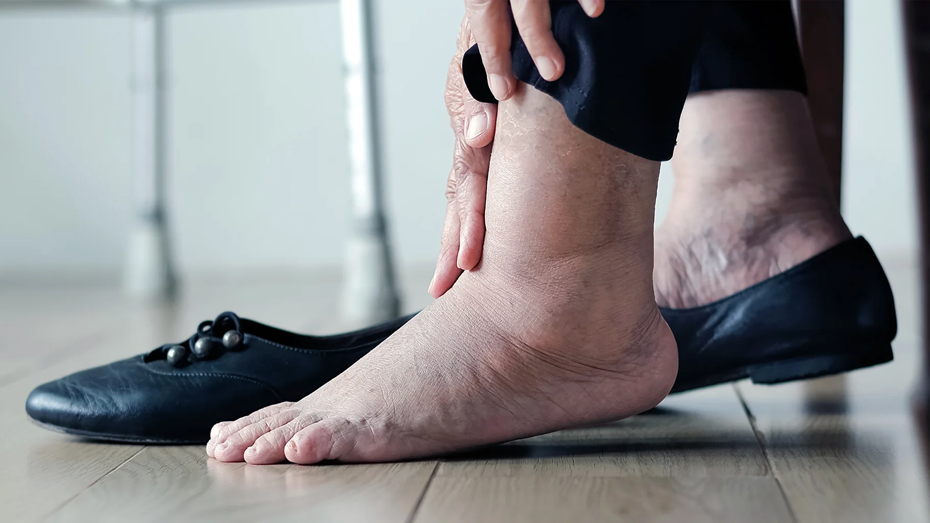 A close-up of a person with a swollen ankle, with their shoes on a wooden floor.