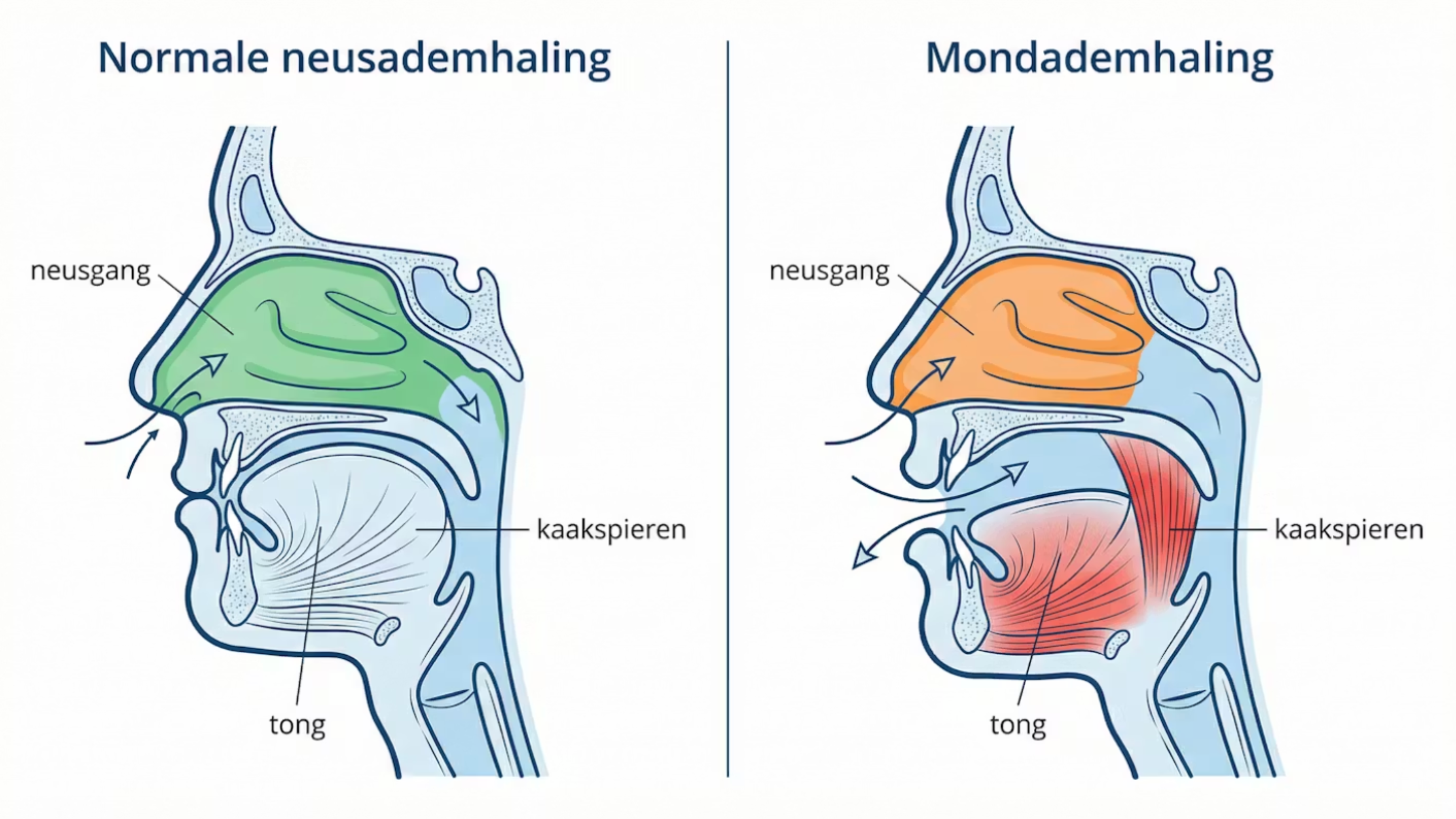 A side-by-side medical illustration comparing the mechanics of nose breathing and mouth breathing in a human head.