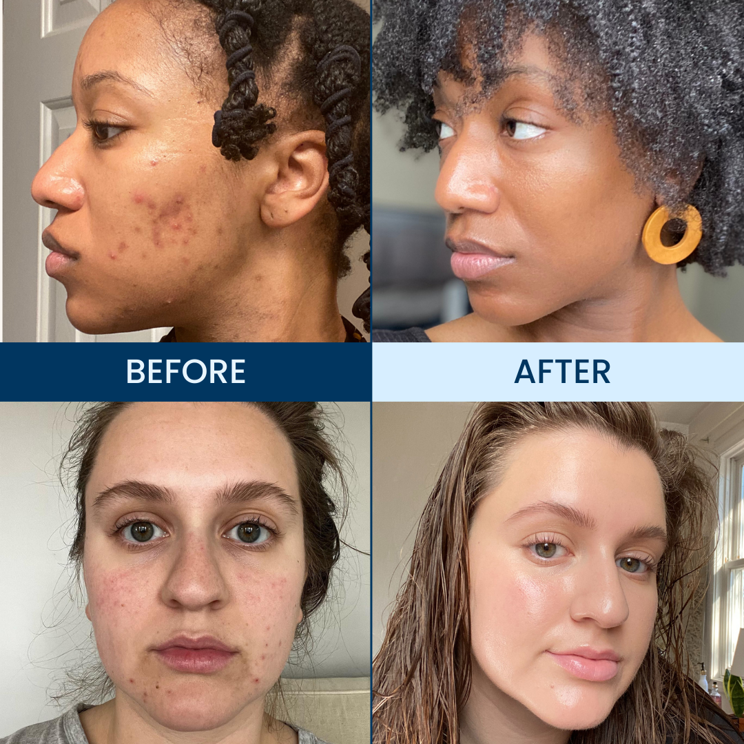 Before and After Image