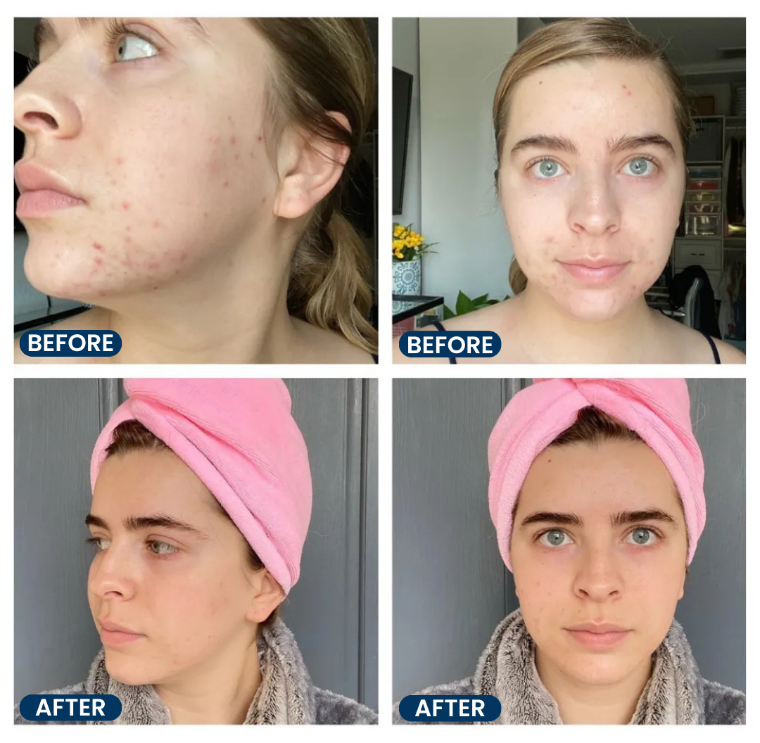 Image of two before and after images