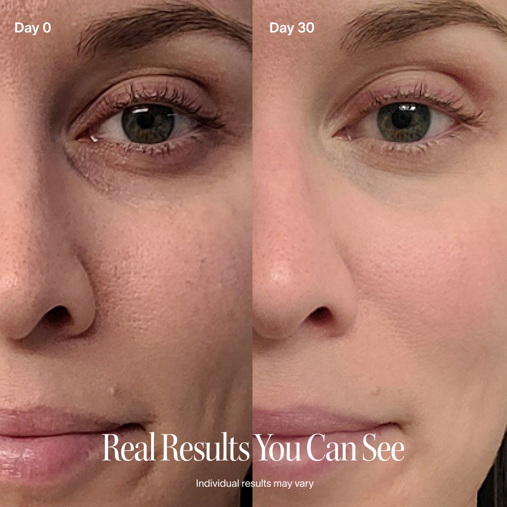 Side-by-side comparison of a woman's face on Day 0 and Day 30.