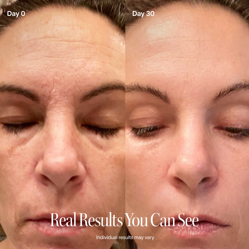 Comparison of a woman's face from Day 0 to Day 30 with visible skin changes.