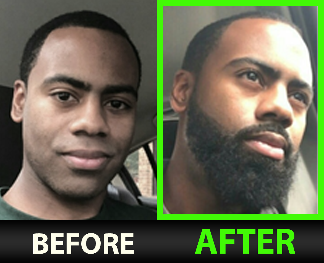 Two side-by-side images labeled 'Before' and 'After' showing a person with and without a beard.