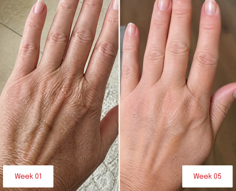 A side-by-side before and after image showing a hand with fewer wrinkles from week one to week five.